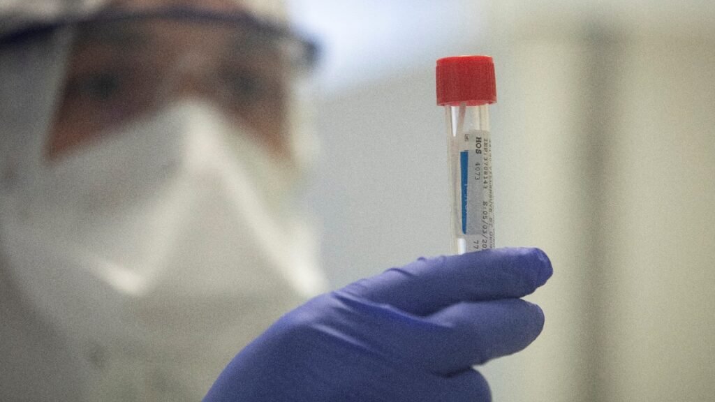 La OMS no descarta que el virus de la covid se originara por una fuga en un laboratorio